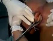 Фаллоимитаторы - Смертельная опасность! Видео в котором девушке делают операцию, по извлечению секс игрушки из анального отверстия